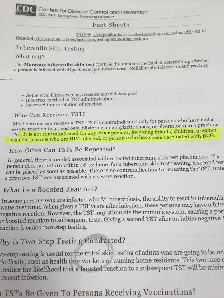 TB test CDC