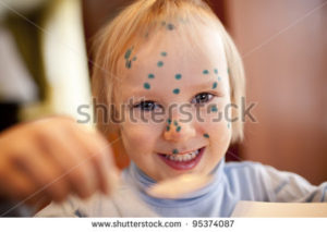 pox stock photos